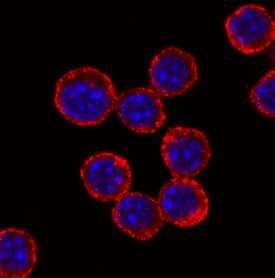 TLR4 was detected in immersion fixed RAW 264.7 mouse monocyte/macrophage cell line using Rabbit Anti-Mouse TLR4 Monoclonal Antibody (Catalog # MAB27591) at 1 µg/mL for 3 hours at room temperature. Cells were stained using the NorthernLights™ 557-conjugated Anti-Rabbit IgG Secondary Antibody (red; Catalog # NL004) and counterstained with DAPI (blue). Specific staining was localized to cell surfaces and cytoplasm. View our protocol for Fluorescent ICC Staining of Non-adherent Cells.