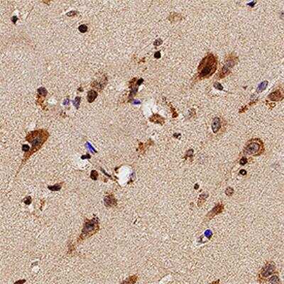 Immunohistochemistry-Paraffin: TLR7 Antibody [NB100-56588] - Analysis of FFPE human brain using TLR7 antibody at 1:20 on a Bond Rx autostainer (Leica Biosystems). The assay involved 20 minutes of heat induced antigen retrieval (HIER) using 10 mM sodium citrate buffer (pH 6.0) and endogenous peroxidase quenching with peroxide block. The sections were incubated with primary antibody for 30 minutes and Bond Polymer Refine Detection (Leica Biosystems) with DAB was used for signal development followed by counterstaining with hematoxylin. Whole slide scanning and capturing of representative images was performed using Aperio AT2 (Leica Biosystems). Neuronal staining of TLR7 was observed. Staining was performed by Histowiz.
