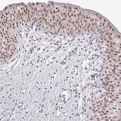 Immunohistochemistry-Paraffin: TMED5 Antibody [NBP2-13440] - Staining of human urinary bladder shows moderate nuclear positivity in urothelial cells.