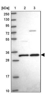 Western Blot: TMED5 Antibody [NBP2-13440] - Lane 1: Marker  [kDa] 250, 130, 95, 72, 55, 36, 28, 17, 10.  Lane 2: Human cell line RT-4.  Lane 3: Human cell line U-251MG sp