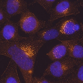 TMEM59 was detected in immersion fixed HeLa human cervical epithelial carcinoma cell line using Mouse Anti-Human TMEM59 Monoclonal Antibody (Catalog # MAB9118) at 25 µg/mL for 3 hours at room temperature. Cells were stained using the NorthernLights™ 557-conjugated Anti-Mouse IgG Secondary Antibody (red; Catalog # NL007) and counterstained with DAPI (blue). Specific staining was localized to cytoplasm. View our protocol for Fluorescent ICC Staining of Cells on Coverslips.