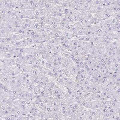 TMEM79 Antibody (NBP2-47601): Novus Biologicals