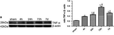 Western Blot: TNF-alpha Antibody - Azide Free [NB600-587] - Expression of TNF-alpha, IL-1beta and NF-kappaB in the brains of MCAO rats. Western blot confirmed that protein levels of TNF-alpha increased as early as 4 h after reperfusion, further increased at 24 h, peaked at 72 h and decreased at 7 days, respectively (*P<0.001, compared with the controls; #P<0.001 compared with the previous time point). Five rats in each group were used for western blot (n=5), sham, sham-operated control rats  Image collected and cropped by CiteAb from the following publication (//www.nature.com/articles/cddis2014586), licensed under a CC-BY licence.