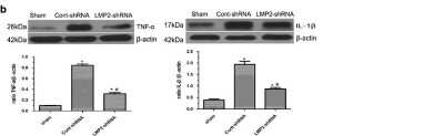 Western Blot: TNF-alpha Antibody - Azide Free [NB600-587] - Expression of TNF-alpha, IL-1beta and NF-kappaB in the brains of MCAO rats. Western blot confirmed that protein levels of TNF-alpha increased as early as 4 h after reperfusion, further increased at 24 h, peaked at 72 h and decreased at 7 days, respectively (*P<0.001, compared with the controls; #P<0.001 compared with the previous time point). Five rats in each group were used for western blot (n=5), sham, sham-operated control rats  Image collected and cropped by CiteAb from the following publication (//www.nature.com/articles/cddis2014586), licensed under a CC-BY licence.