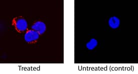 TNF-a was detected in immersion fixed canine peripheral blood mononuclear cells (PBMCs) stimulated with PMA and calcium ionomycin using Goat Anti-Canine TNF-a Antigen Affinity-purified Polyclonal Antibody (Catalog # AF1507) at 15 µg/mL for 3 hours at room temperature. Cells were stained using the NorthernLights™ 557-conjugated Anti-Goat IgG Secondary Antibody (red; NL001) and counterstained with DAPI (blue). Specific staining was localized to cytoplasm. View our protocol for Fluorescent ICC Staining of Non-adherent Cells.