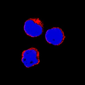 TNF-a was detected in immersion fixed equine peripheral blood mononuclear cells (PBMCs) using Goat Anti-Equine TNF-a Antigen Affinity-purified Polyclonal Antibody (Catalog # AF1814) at 15 µg/mL for 3 hours at room temperature. Cells were stained using the NorthernLights™ 557-conjugated Anti-Goat IgG Secondary Antibody (red; Catalog # NL001) and counterstained with DAPI (blue). Specific staining was localized to cytoplasm. View our protocol for Fluorescent ICC Staining of Non-adherent Cells.
