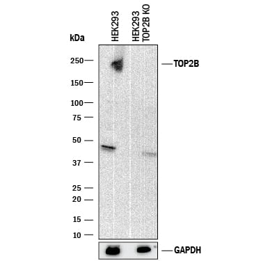 <b>Genetic Strategies Validation. </b>Western blot shows lysates of HEK293 human embryonic kidney parental cell line and TOP2B knockout HEK293 cell line (KO). PVDF membrane was probed with 0.2 µg/mL of Sheep Anti-Human TOP2B Antigen Affinity-purified Polyclonal Antibody (Catalog # AF6348) followed by HRP-conjugated Anti-Sheep IgG Secondary Antibody (Catalog # HAF016). A specific band was detected for TOP2B at approximately 245 kDa (as indicated) in the parental HEK293 cell line, but is not detectable in knockout HEK293 cell line. GAPDH (Catalog # AF5718) is shown as a loading control. This experiment was conducted under reducing conditions and using Immunoblot Buffer Group 1.