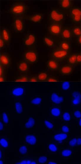 TOP2B was detected in immersion fixed HeLa human cervical epithelial carcinoma cell line using Mouse Anti-Human/Mouse TOP2B Monoclonal Antibody (Catalog # MAB6348) at 25 µg/mL for 3 hours at room temperature. Cells were stained using the NorthernLights™ 557-conjugated Anti-Mouse IgG Secondary Antibody (red, upper panel; Catalog # NL007) and counterstained with DAPI (blue, lower panel). Specific staining was localized to nuclei. View our protocol for Fluorescent ICC Staining of Cells on Coverslips.