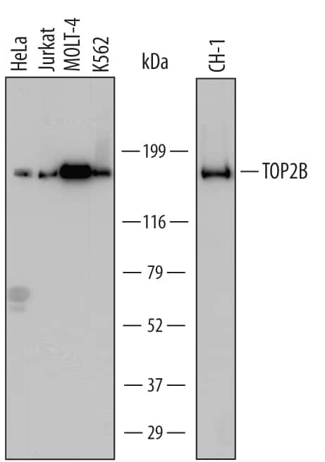 Western blot shows lysates of HeLa human cervical epithelial carcinoma cell line, Jurkat human acute T cell leukemia cell line, MOLT-4 human acute lymphoblastic leukemia cell line, K562 human chronic myelogenous leukemia cell line, and CH-1 mouse B cell lymphoma cell line. PVDF Membrane was probed with 1 µg/mL of Mouse Anti-Human/Mouse TOP2B Monoclonal Antibody (Catalog # MAB6348) followed by HRP-conjugated Anti-Mouse IgG Secondary Antibody (Catalog # HAF007). A specific band was detected for TOP2B at approximately 185 kDa (as indicated). This experiment was conducted under reducing conditions and using Immunoblot Buffer Group 1.