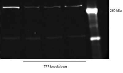 TPR Antibody (NB100-2866): Novus Biologicals