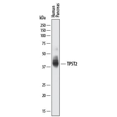 Western blot shows lysates of human pancreas tissue. PVDF membrane was probed with 0.5 µg/mL of Sheep Anti-Human Tyrosylprotein Sulfotransferase 2/TPST2 Antigen Affinity-purified Polyclonal Antibody (Catalog # AF6236) followed by HRP-conjugated Anti-Sheep IgG Secondary Antibody (Catalog # HAF016). A specific band was detected for Tyrosylprotein Sulfotransferase 2/TPST2 at approximately 42 kDa (as indicated). This experiment was conducted under reducing conditions and using Immunoblot Buffer Group 1.