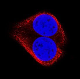 TRADD was detected in immersion fixed MCF-7 human breast cancer cell line using Mouse Anti-Human TRADD Monoclonal Antibody (Catalog # MAB2658) at 3 µg/mL for 3 hours at room temperature. Cells were stained using the NorthernLights™ 557-conjugated Anti-Mouse IgG Secondary Antibody (red; NL007) and counterstained with DAPI (blue). Specific staining was localized to cytoplasm. View our protocol for Fluorescent ICC Staining of Cells on Coverslips.