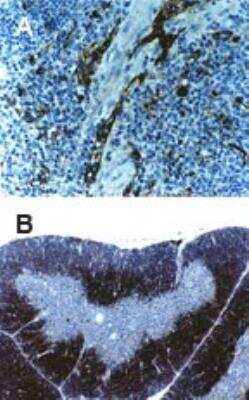 Immunohistochemistry-Paraffin: TRAF-6 Antibody [NB100-56179] -  Stained for TRAF6 using this antibody at 1:2000. Hematoxylin-eosin counterstain. A, mouse spleen. B, mouse thymus.