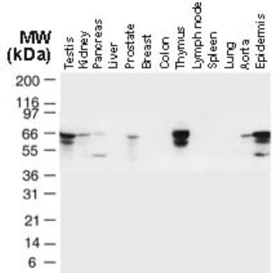 Western Blot: TRAF-6 Antibody [NB100-56179] - Analysis of TRAF-6 in normal Human tissues using this antibody. TRAF6 is observed at ~66 kDa. Additional bands of lower molecular weight were seen in some cases, and may represent TRAF-6 degradation fragments.