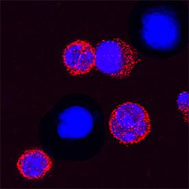 TREM-1 was detected in immersion fixed mouse splenocytes treated with LPS using Rat Anti-Mouse TREM-1 Monoclonal Antibody (Catalog # MAB1187) at 15 µg/mL for 3 hours at room temperature. Cells were stained using the NorthernLights™ 557-conjugated Anti-Rat IgG Secondary Antibody (red; Catalog # NL013) and counterstained with DAPI (blue). Specific staining was localized to cytoplasm. View our protocol for Fluorescent ICC Staining of Non-adherent Cells.