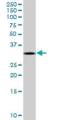 TREX1 Antibodies: Novus Biologicals