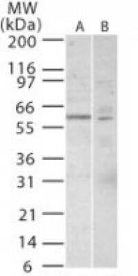 Western Blot: TRF-1 Antibody [NB600-1391] - Analysis ofTRF1 in 20 ugs of A) Jurkat and B) 293 cell lysateusing this antibody.