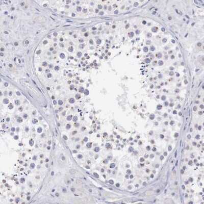 Immunohistochemistry-Paraffin TRIM13 Antibody