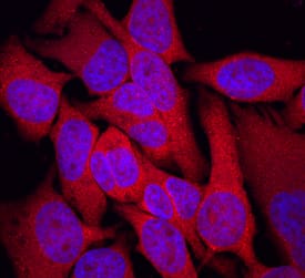 TRIM32 was detected in immersion fixed HeLa human cervical epithelial carcinoma cell line using Sheep Anti-Human/Mouse TRIM32 Antigen Affinity-purified Polyclonal Antibody (Catalog # AF6515) at 10 µg/mL for 3 hours at room temperature. Cells were stained using the NorthernLights™ 557-conjugated Anti-Sheep IgG Secondary Antibody (red; Catalog # NL010) and counterstained with DAPI (blue). Specific staining was localized to cytoplasm. View our protocol for Fluorescent ICC Staining of Cells on Coverslips.