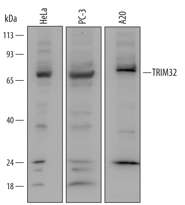 Western blot shows lysates of HeLa human cervical epithelial carcinoma cell line, PC-3 human prostate cancer cell line, and A20 mouse B cell lymphoma cell line. PVDF Membrane was probed with 0.5 µg/mL of Sheep Anti-Human/Mouse TRIM32 Antigen Affinity-purified Polyclonal Antibody (Catalog # AF6515) followed by HRP-conjugated Anti-Sheep IgG Secondary Antibody (Catalog # HAF016). A specific band was detected for TRIM32 at approximately 72 kDa (as indicated). This experiment was conducted under reducing conditions and using Immunoblot Buffer Group 2.