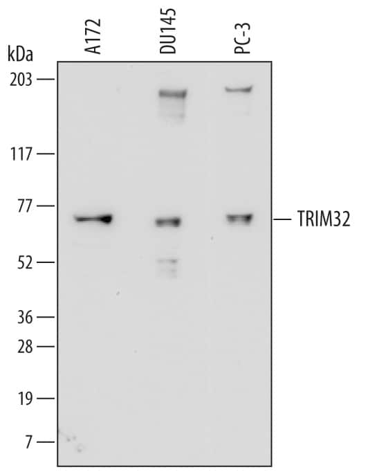 Western blot shows lysates of A172 human glioblastoma cell line, DU145 human prostate carcinoma cell line, and PC-3 human prostate cancer cell line. PVDF membrane was probed with 0.25 µg/mL of Mouse Anti-Human TRIM32 Monoclonal Antibody (Catalog # MAB6515) followed by HRP-conjugated Anti-Mouse IgG Secondary Antibody (Catalog # HAF007). A specific band was detected for TRIM32 at approximately 72 kDa (as indicated). This experiment was conducted under reducing conditions and using Immunoblot Buffer Group 1.