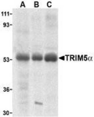 Western Blot: TRIM5 alpha Antibody [NBP1-76601] - Human stomach (A), thymus (B), and uterus (C) cell lysate with TRIM5 alpha antibody at 2 ug /ml.