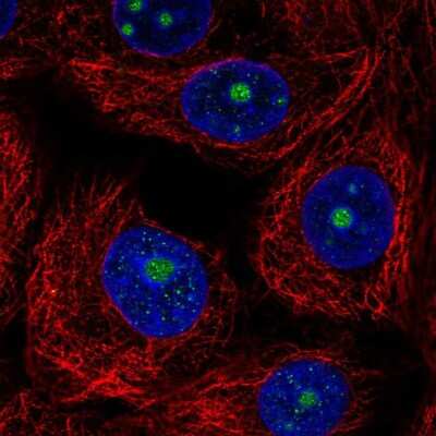 TRIM52 Antibody (NBP2-31651): Novus Biologicals