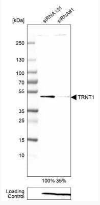 Western Blot: TRNT1 Antibody [NBP1-86589] - Analysis in A-549 cells transfected with control siRNA, target specific siRNA probe #1, using Anti-TRNT1 antibody. Remaining relative intensity is presented. Loading control: Anti-PPIB.