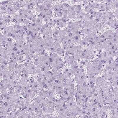 TROP-2 Antibody (NBP2-49166): Novus Biologicals