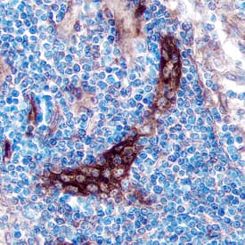 TSLP R was detected in immersion fixed paraffin-embedded sections of human lymph node using Goat Anti-Human TSLP R Antigen Affinity-purified Polyclonal Antibody (Catalog # AF981) at 5 µg/mL overnight at 4 °C. Tissue was stained using the Anti-Goat HRP-DAB Cell & Tissue Staining Kit (brown; Catalog # CTS008) and counter-stained with hematoxylin (blue). Specific staining was localized to the plasma membrane. View our protocol for Chromogenic IHC Staining of Paraffin-embedded Tissue Sections.