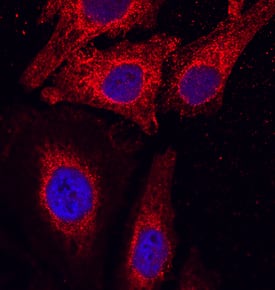 TSPAN12 was detected in immersion fixed HeLa human cervical epithelial carcinoma cell line using Mouse Anti-Human TSPAN12 Monoclonal Antibody (Catalog # MAB8910) at 10 µg/mL for 3 hours at room temperature. Cells were stained using the NorthernLights™ 557-conjugated Anti-Mouse IgG Secondary Antibody (red; Catalog # NL007) and counterstained with DAPI (blue). Specific staining was localized to cytoplasm. View our protocol for Fluorescent ICC Staining of Cells on Coverslips.