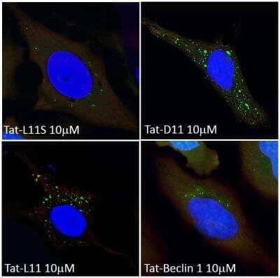 Immunocytochemistry/Immunofluorescence: Tat-Beclin 1 L11 Autophagy Inducing Peptide [NBP2-49886] - HeLa GFP-LC3B cells were treated with Tat-D11, Tat-L11, Tat-Beclin 1 or Tat-L11S for 1.5 hours. Thereafter, the cells were stained using NeuroTrace Red or DAPI and analyzed employing fluorescent microscopy. Note the higher number of autophagosomes/GFP-LC3B+ puncta in the images of Tat-D11 and Tat-L11 treated cells when compared to Tat-Beclin 1 and Tat-L11S treated cells.