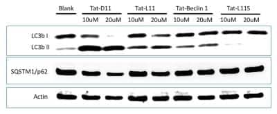 Western Blot: Tat-Beclin 1 L11 Autophagy Inducing Peptide [NBP2-49886] - WB analysis of lysates from HeLa cells that were left untreated (blank) or were treated with 10-20 uM each of Tat-D11, Tat-L11, Tat-Beclin 1 or Tat-L11S. The lysates were analyzed for the expression of LC3-1/LC3-II and SQSTM1/p62 using 2ug/ml each of anti-LC3B (NB100-2220) and anti-SQSTM1/p62 (MAB8028) respectively. Anti-Actin (AF4000) was used as a loading control. TatD11 exhibited superior induction of LC3-II and down-regulation of p62 protein when compared to other treatment and control groups.