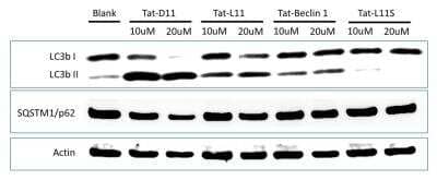 Western Blot: Tat-Beclin 1 L11S Autophagy Inducing Peptide - Inactive Form [NBP2-49887] - WB analysis of lysates from HeLa cells that were left untreated (blank) or were treated with 10-20 uM each of Tat-D11, Tat-L11, Tat-Beclin 1 or Tat-L11S. The lysates were analyzed for the expression of LC3-1/LC3-II and SQSTM1/p62 using 2ug/ml each of anti-LC3B (NB100-2220) and anti-SQSTM1/p62 (MAB8028) respectively. Anti-Actin (AF4000) was used as a loading control. TatD11 exhibited superior induction of LC3-II and down-regulation of p62 protein when compared to other treatment and control groups. 
