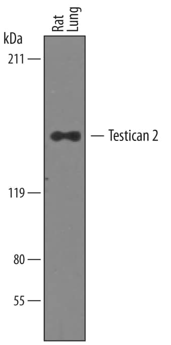 Western blot shows lysates of rat lung tissue. PVDF membrane was probed with 0.1 µg/mL of Goat Anti-Human Testican 2/SPOCK2 Biotinylated Antigen Affinity-purified Polyclonal Antibody (Catalog # BAF2328) followed by HRP-conjugated Anti-Goat IgG Secondary Antibody (Catalog # HAF019). A specific band was detected for Testican 2/SPOCK2 at approximately 140 kDa (as indicated). This experiment was conducted under reducing conditions and using Immunoblot Buffer Group 8.