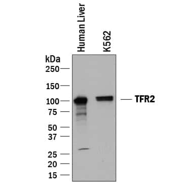 Western Blot TfR2 Antibody [Unconjugated]