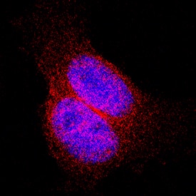 Thioredoxin-1 was detected in immersion fixed HeLa human cervical epithelial carcinoma cell line using Mouse Anti-Human/Mouse/Rat Thioredoxin-1 Monoclonal Antibody (Catalog # MAB19701) at 8 µg/mL for 3 hours at room temperature. Cells were stained using the NorthernLights™ 557-conjugated Anti-Mouse IgG Secondary Antibody (red; Catalog # NL007) and counterstained with DAPI (blue). Specific staining was localized to cytoplasm. View our protocol for Fluorescent ICC Staining of Cells on Coverslips.