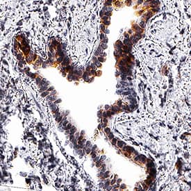   Thioredoxin‑1  was detected in immersion fixed paraffin-embedded sections of human lung  using Mouse Anti-Human/Mouse/Rat Thioredoxin‑1 Monoclonal Antibody (Catalog  # MAB19701) at 5 µg/mL for 1 hour at room temperature  followed by incubation with the Anti-Mouse IgG VisUCyte™ HRP  Polymer Antibody (Catalog # VC001).  Before incubation with the primary antibody, tissue was subjected to  heat-induced epitope retrieval using Antigen Retrieval Reagent-Basic (Catalog  # CTS013).  Tissue was stained using DAB (brown) and counterstained with hematoxylin  (blue). Specific staining was localized to cytoplasm in alveolar cells. View  our protocol for IHC  Staining with VisUCyte HRP Polymer Detection Reagents.