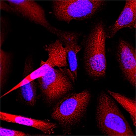 Thioredoxin-1 was detected in immersion fixed HeLa human cervical epithelial carcinoma cell line using Mouse Anti-Human Thioredoxin-1 Monoclonal Antibody (Catalog # MAB1970) at 3 µg/mL for 3 hours at room temperature. Cells were stained using the NorthernLights™ 557-conjugated Anti-Mouse IgG Secondary Antibody (red; Catalog # NL007) and counterstained with DAPI (blue). Specific staining was localized to cytoplasm. View our protocol for Fluorescent ICC Staining of Cells on Coverslips.