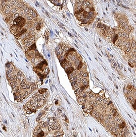 Immunohistochemistry Thymidine Kinase 1 Antibody [Unconjugated]