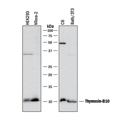 Western Blot Thymosin beta 10 Antibody [Unconjugated]