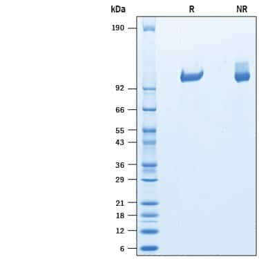 2 μg/lane of Recombinant Human Tie-2 His-tag Protein (Catalog # 10457-TI) was  resolved with SDS-PAGE under reducing (R) and non-reducing (NR)  conditions and visualized by Coomassie® Blue staining, showing bands at  kDa.