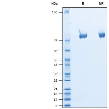 2 μg/lane of Recombinant Rat Tie-2 His-tag Protein (Catalog # 10458-T2) was resolved with SDS-PAGE under reducing (R) and non-reducing (NR) conditions and visualized by Coomassie® Blue staining, showing bands at kDa.