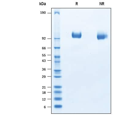 2 μg/lane of Recombinant Porcine Tie-2 His-tag Protein (Catalog # 10492-T2) was resolved withSDS-PAGE under reducing (R) and non-reducing (NR) conditions and visualized byCoomassie® Blue staining, showing bands at kDa.