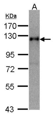 Timeless Antibody (NBP1-32404): Novus Biologicals