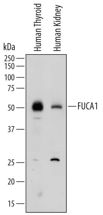 Western blot shows lysates of human thyroid tissue and human kidney tissue. PVDF membrane was probed with 1 µg/mL of Sheep Anti-Human Tissue a-L-Fucosidase/FUCA1 Antigen Affinity-purified Polyclonal Antibody (Catalog # AF7039) followed by HRP-conjugated Anti-Sheep IgG Secondary Antibody (Catalog # HAF016). A specific band was detected for Tissue a-L-Fucosidase/FUCA1 at approximately 50 kDa (as indicated). This experiment was conducted under reducing conditions and using Immunoblot Buffer Group 1.