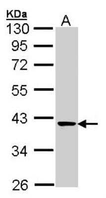 Transaldolase 1 Antibody (NBP1-32121): Novus Biologicals