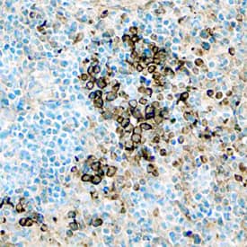 Transferrin was detected in perfusion fixed frozen sections of mouse thymus using Goat Anti-Mouse Transferrin Antigen Affinity-purified Polyclonal Antibody (Catalog # AF3987) at 5 µg/mL overnight at 4 °C. Tissue was stained using the Anti-Goat HRP-DAB Cell & Tissue Staining Kit (brown; Catalog # CTS008) and counterstained with hematoxylin (blue). Specific staining was localized to the plasma membranes of lymphocytes. View our protocol for Chromogenic IHC Staining of Frozen Tissue Sections.