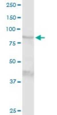 Transglutaminase 1/TGM1 Antibodies: Novus Biologicals