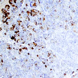 Trypsin was detected in immersion fixed paraffin-embedded sections of human pancreas using Sheep Anti-Human Trypsin Pan Specific (PRSS1/2/3) Antigen Affinity-purified Polyclonal Antibody (Catalog # AF3586) at 15 µg/mL overnight at 4 °C. Tissue was stained using the Anti-Sheep HRP-DAB Cell & Tissue Staining Kit (brown; Catalog # CTS019) and counterstained with hematoxylin (blue). Specific staining was localized to exocrine cells. View our protocol for Chromogenic IHC Staining of Paraffin-embedded Tissue Sections.